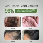 Before and after hairfall results showing reduced hair shedding with Aloe Pure Shampoo